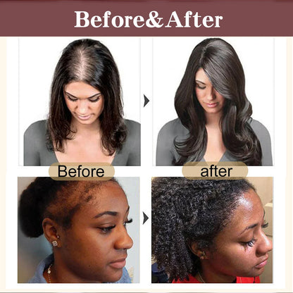 100% Organic Batana Oil: Hair & Scalp Treatment