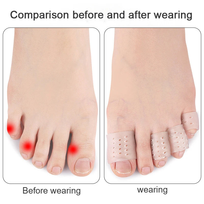 Silicone Toe Protectors: Blister & Friction Relief